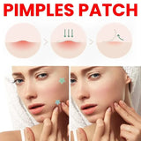 Acne Repair Facial Patch